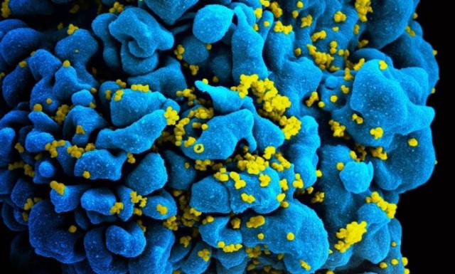 hiv-niaid.jpg-00.jpg